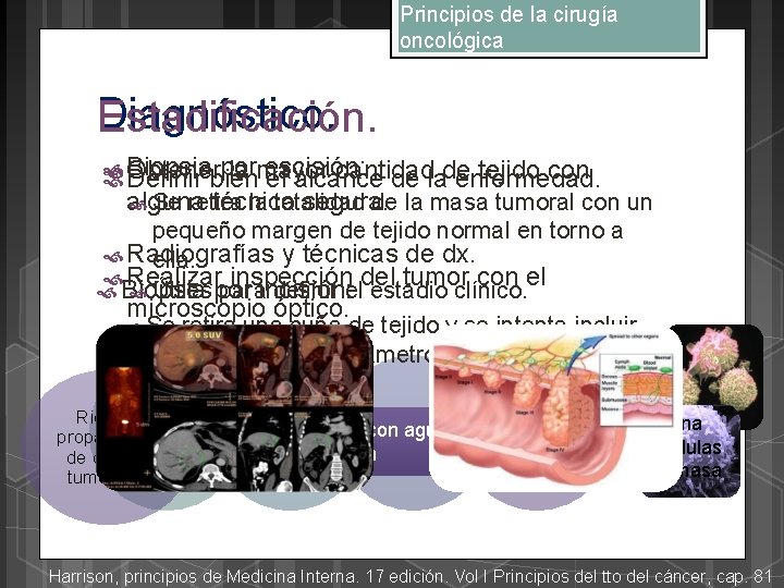 Principios de la cirugía oncológica Diagnóstico. Estadificación. Biopsia por escisión: la mayor cantidad tejido