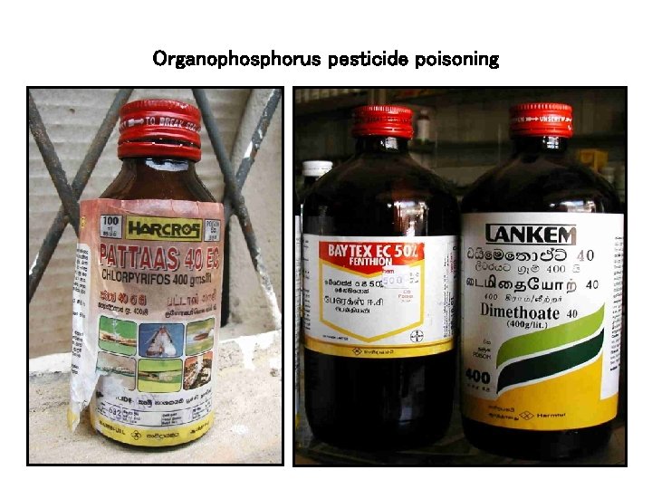 Organophosphorus pesticide poisoning 