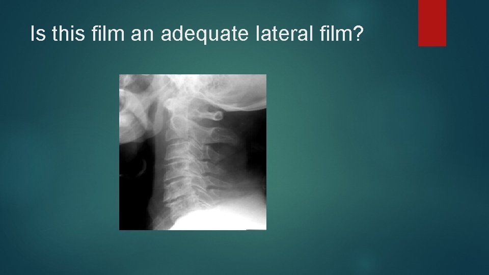 Is this film an adequate lateral film? 