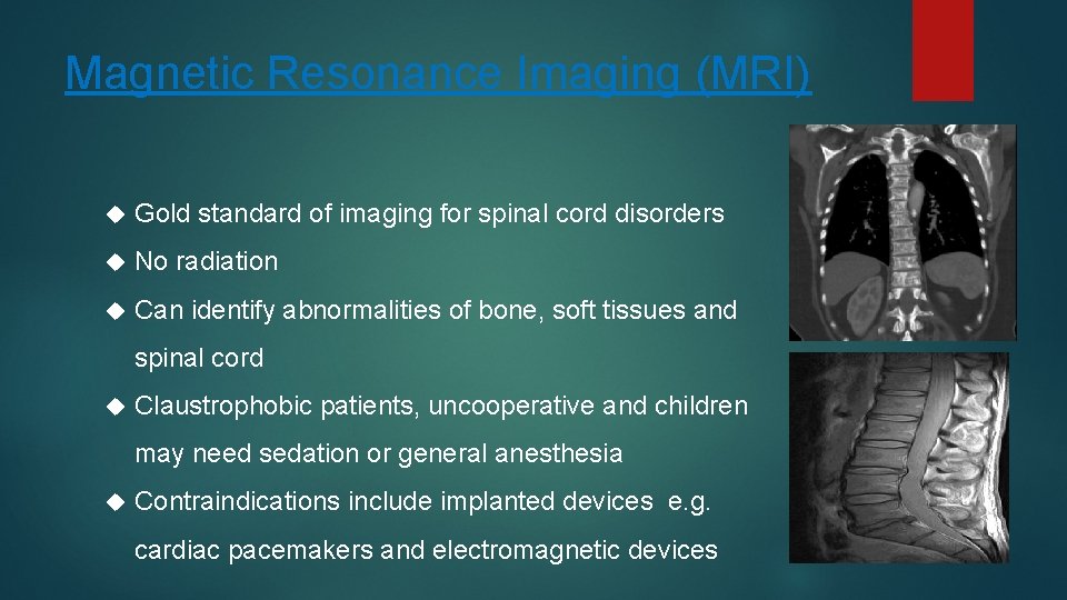 Magnetic Resonance Imaging (MRI) Gold standard of imaging for spinal cord disorders No radiation