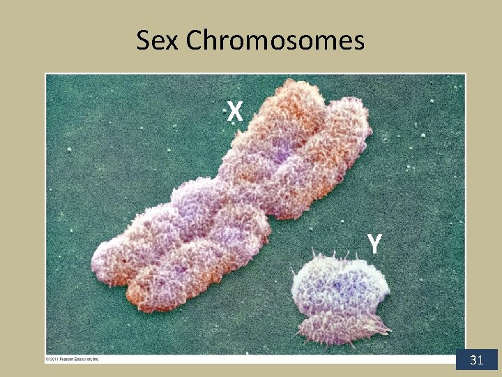 Sex Chromosomes X Y 31 