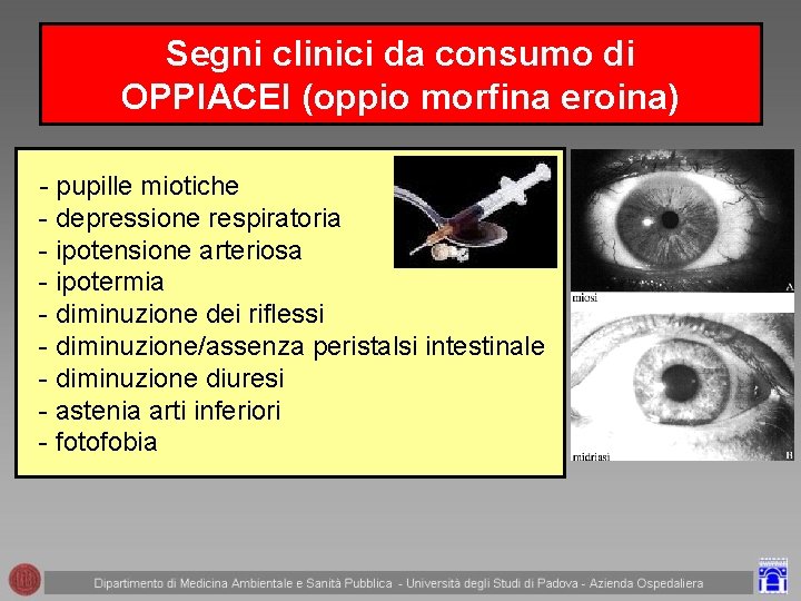 Segni clinici da consumo di OPPIACEI (oppio morfina eroina) - pupille miotiche - depressione