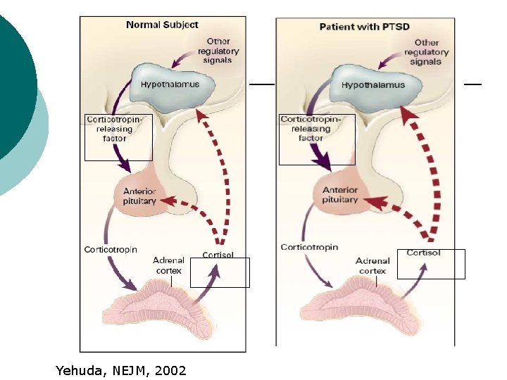 Yehuda, NEJM, 2002 