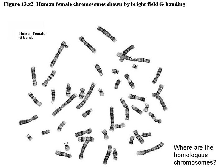 Figure 13. x 2 Human female chromosomes shown by bright field G-banding Where are