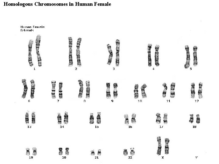 Homologous Chromosomes in Human Female 