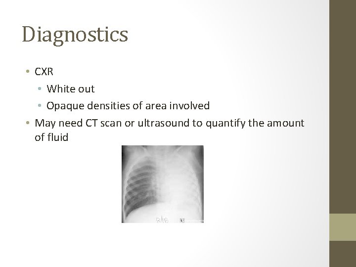 Diagnostics • CXR • White out • Opaque densities of area involved • May