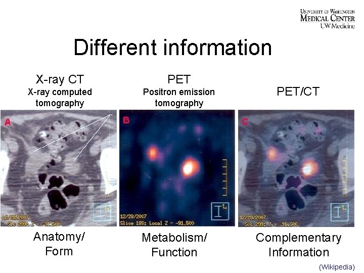 Different information X-ray CT PET X-ray computed tomography Positron emission tomography Anatomy/ Form Metabolism/