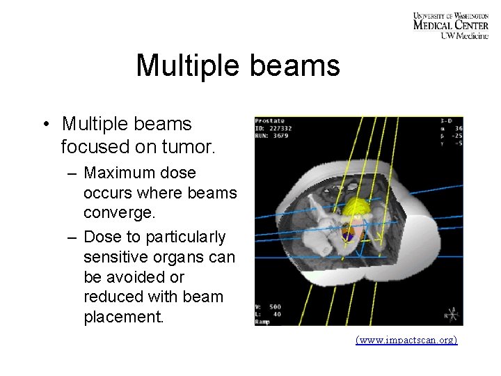 Multiple beams • Multiple beams focused on tumor. – Maximum dose occurs where beams