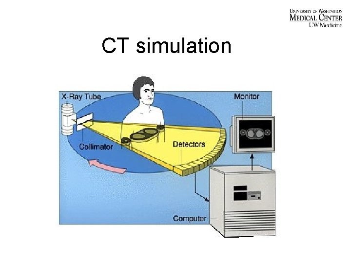 CT simulation 