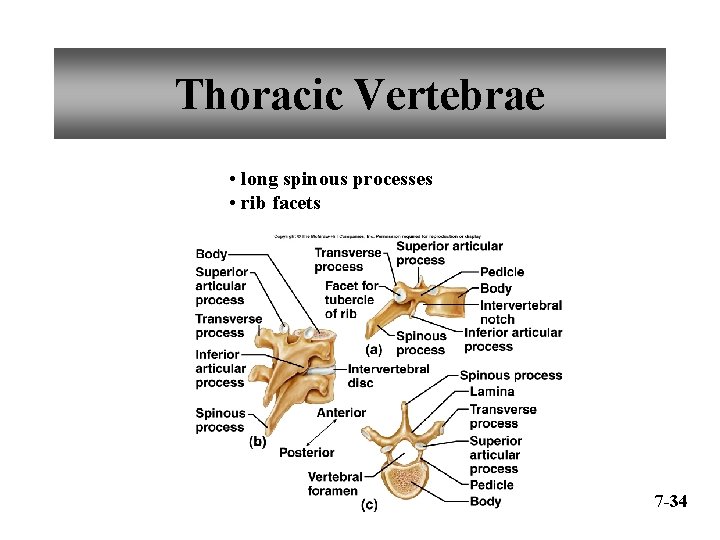 Thoracic Vertebrae • long spinous processes • rib facets 7 -34 