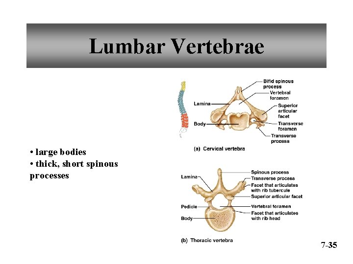 Lumbar Vertebrae • large bodies • thick, short spinous processes 7 -35 