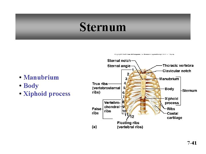 Sternum • Manubrium • Body • Xiphoid process 7 -41 