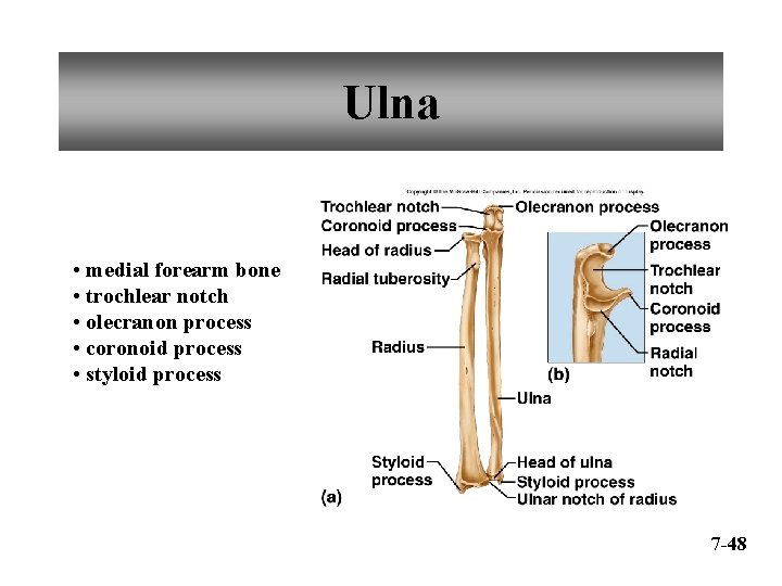 Ulna • medial forearm bone • trochlear notch • olecranon process • coronoid process