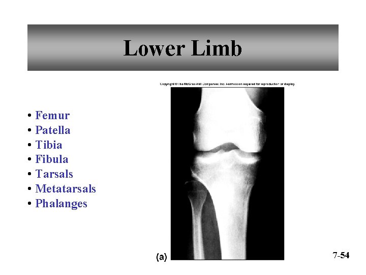 Lower Limb • Femur • Patella • Tibia • Fibula • Tarsals • Metatarsals