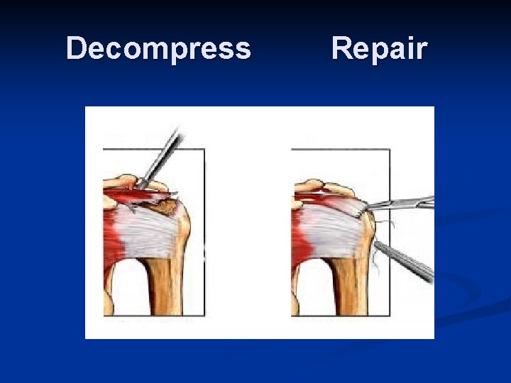 Common Shoulder Problems Ted Parks MD Which structure