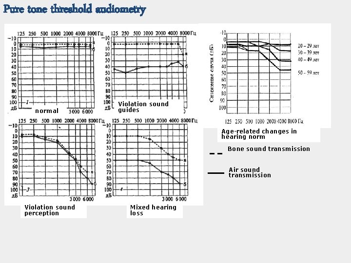 Pure tone threshold audiometry normal Violation sound guides Age-related changes in hearing norm Bone