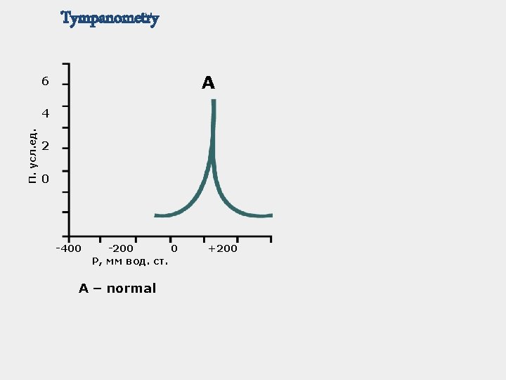 Tympanometry А 6 П. усл. ед. 4 2 0 -400 -200 0 Р, мм