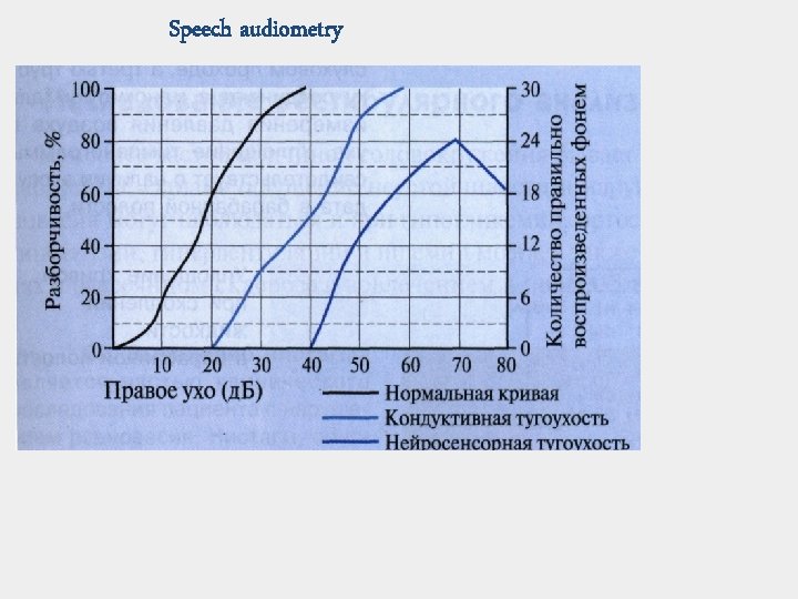 Speech audiometry 