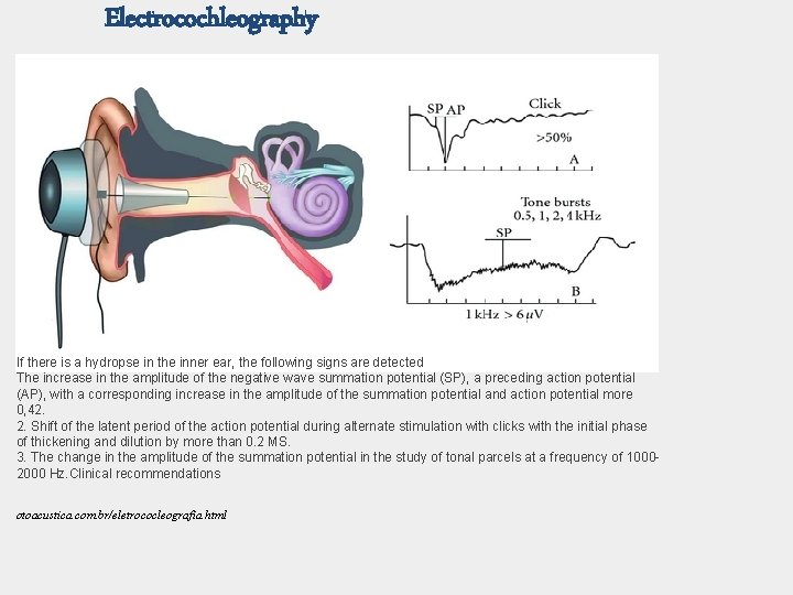 Electrocochleography If there is a hydropse in the inner ear, the following signs are