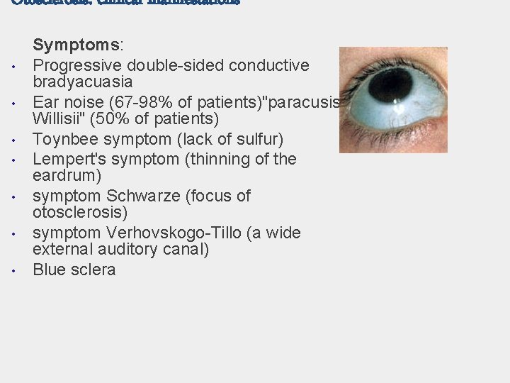 Otosclerosis: clinical manifestations • • Symptoms: Progressive double-sided conductive bradyacuasia Ear noise (67 -98%