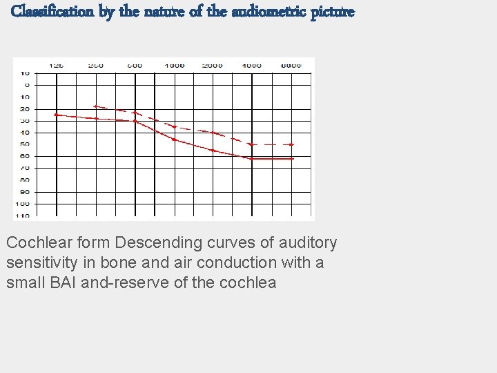 Classification by the nature of the audiometric picture Cochlear form Descending curves of auditory