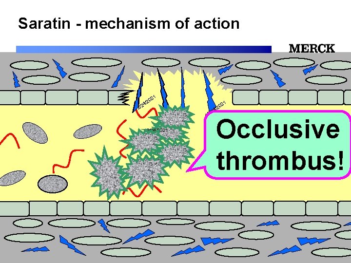 Saratin - mechanism of action 1 02 2 / /24 12/24/2021 12/24/2021 Occlusive thrombus!