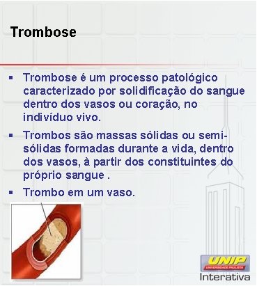 Trombose § Trombose é um processo patológico caracterizado por solidificação do sangue dentro dos