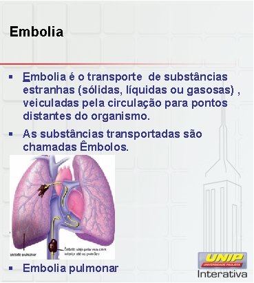 Embolia § Embolia é o transporte de substâncias estranhas (sólidas, líquidas ou gasosas) ,
