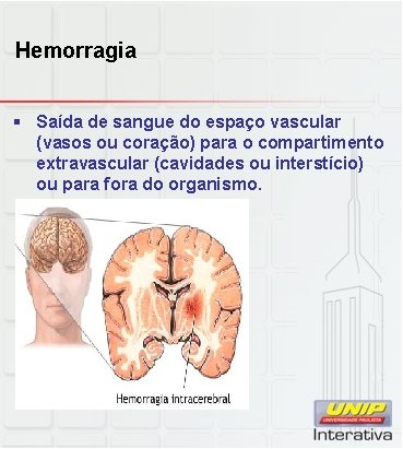 Hemorragia § Saída de sangue do espaço vascular (vasos ou coração) para o compartimento