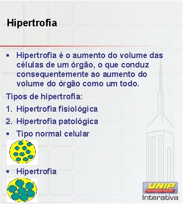 Hipertrofia § Hipertrofia é o aumento do volume das células de um órgão, o