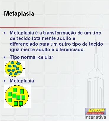 Metaplasia § Metaplasia é a transformação de um tipo de tecido totalmente adulto e