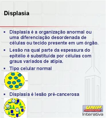 Displasia § Displasia é a organização anormal ou uma diferenciação desordenada de células ou