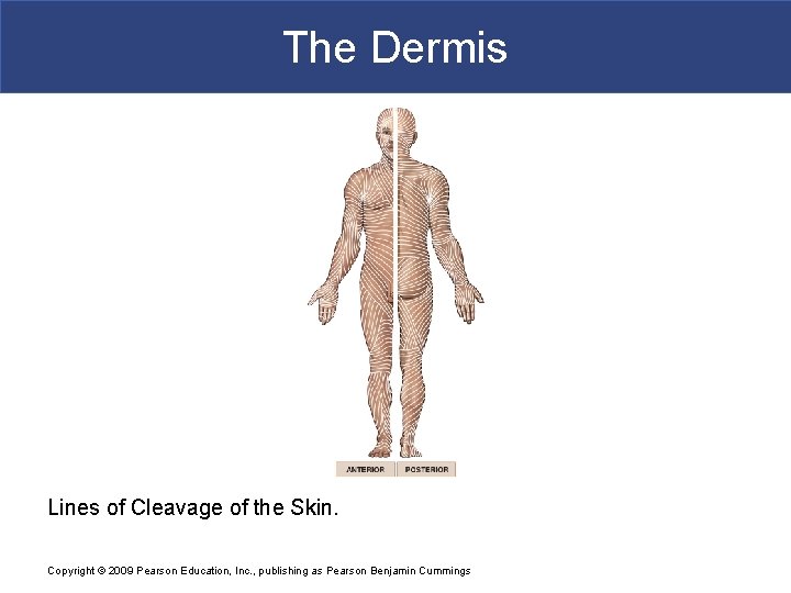 The Dermis Lines of Cleavage of the Skin. Copyright © 2009 Pearson Education, Inc.