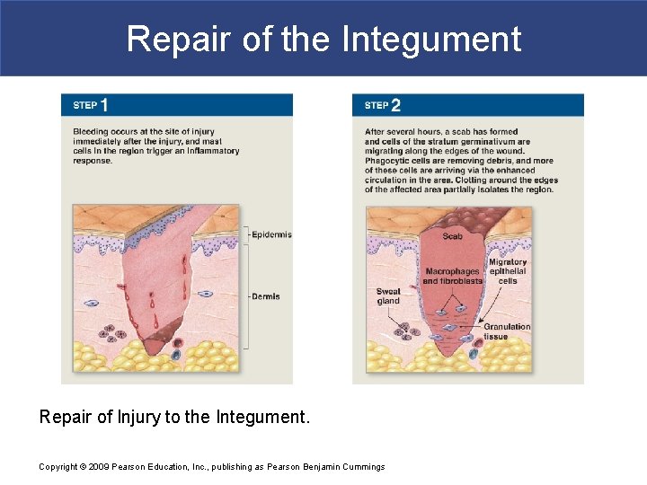 Repair of the Integument Repair of Injury to the Integument. Copyright © 2009 Pearson