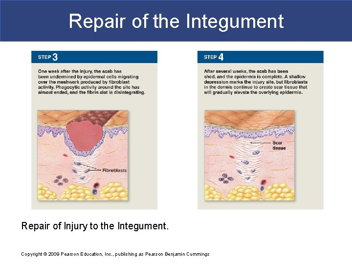 Repair of the Integument Repair of Injury to the Integument. Copyright © 2009 Pearson