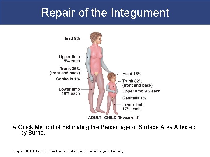 Repair of the Integument A Quick Method of Estimating the Percentage of Surface Area Repair of the Integument A Quick Method of Estimating the Percentage of Surface Area