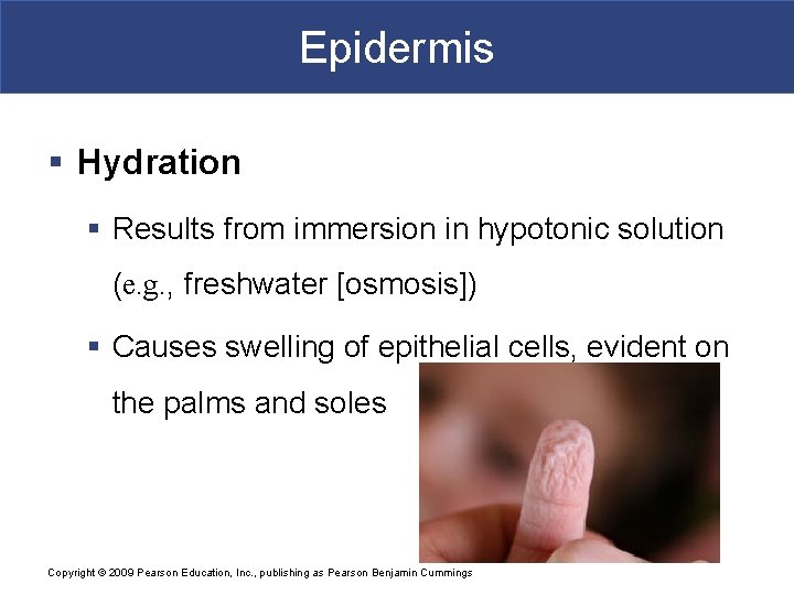 Epidermis § Hydration § Results from immersion in hypotonic solution (e. g. , freshwater Epidermis § Hydration § Results from immersion in hypotonic solution (e. g. , freshwater