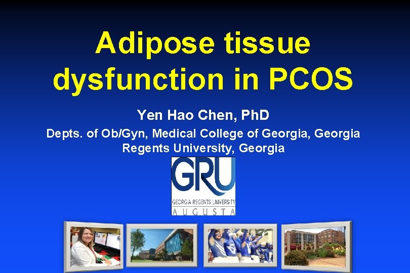 Adipose tissue dysfunction in PCOS Yen Hao Chen, Ph. D Depts. of Ob/Gyn, Medical