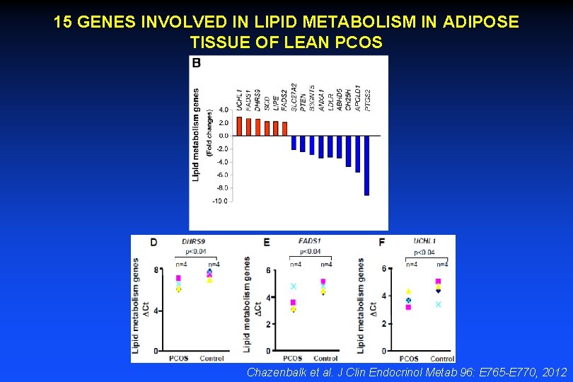 15 GENES INVOLVED IN LIPID METABOLISM IN ADIPOSE TISSUE OF LEAN PCOS Chazenbalk et