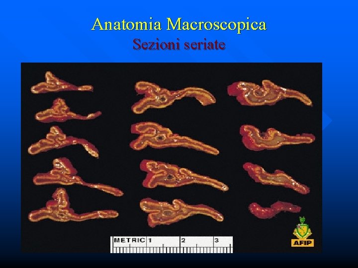 Anatomia Macroscopica Sezioni seriate 