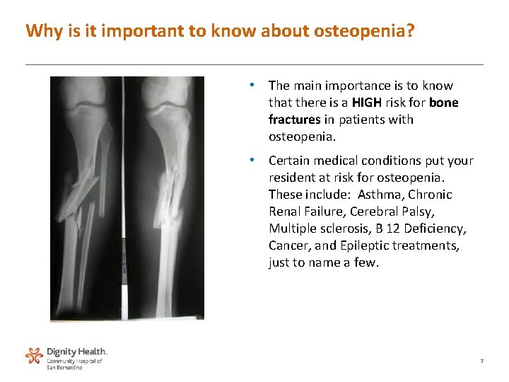 Why is it important to know about osteopenia? • The main importance is to