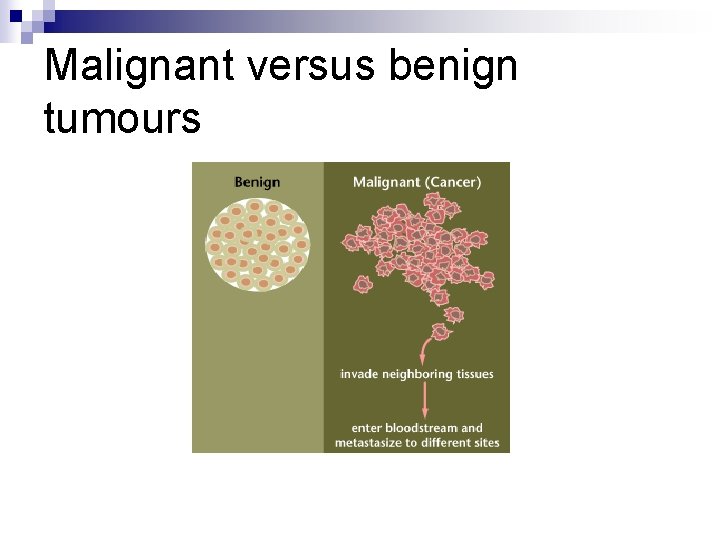 Malignant versus benign tumours 