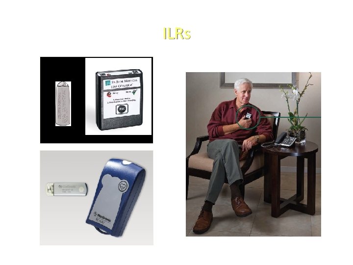 ILRs 