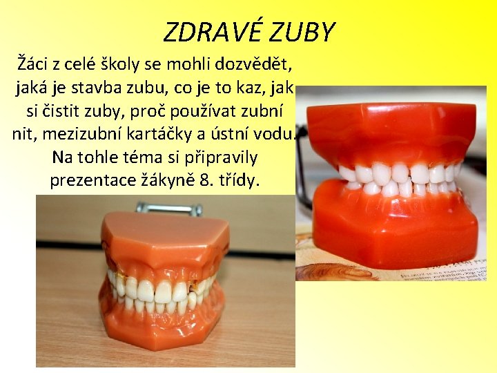 ZDRAVÉ ZUBY Žáci z celé školy se mohli dozvědět, jaká je stavba zubu, co