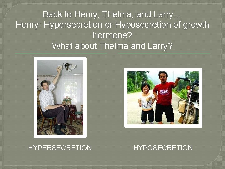 Back to Henry, Thelma, and Larry… Henry: Hypersecretion or Hyposecretion of growth hormone? What