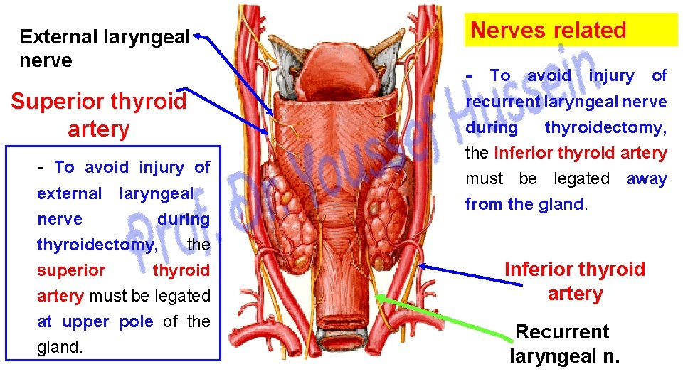 External laryngeal nerve Superior thyroid artery To avoid injury of external laryngeal nerve during