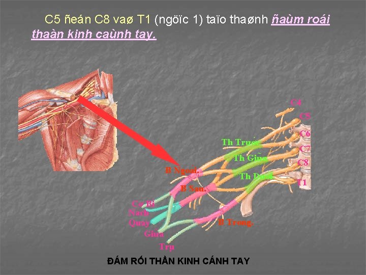 C 5 ñeán C 8 vaø T 1 (ngöïc 1) taïo thaønh ñaùm roái