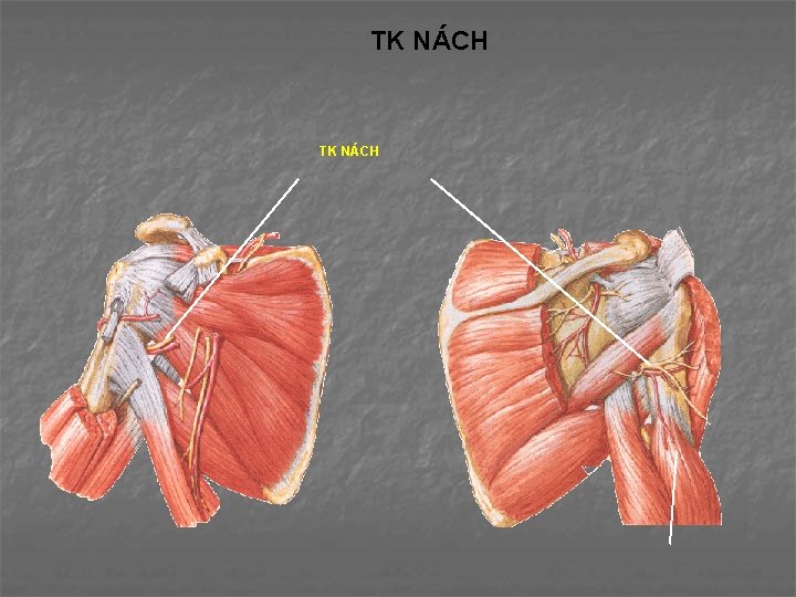 TK NÁCH 