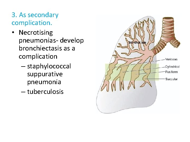 3. As secondary complication. • Necrotising pneumonias- develop bronchiectasis as a complication – staphylococcal