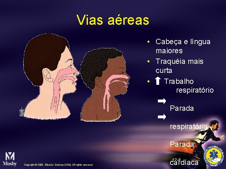 Vias aéreas • Cabeça e língua maiores • Traquéia mais curta • Trabalho respiratório